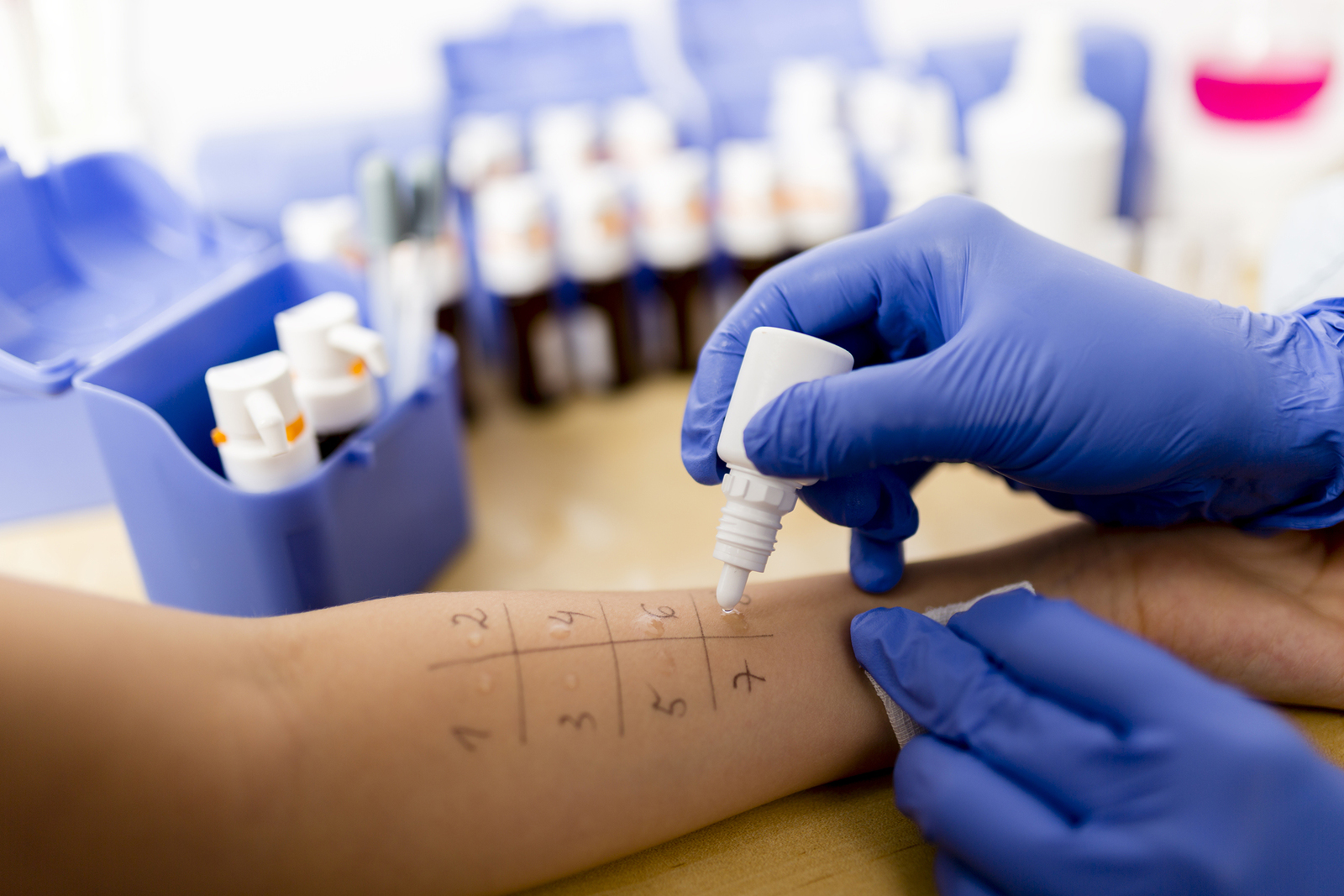 Study Blood And Skin Prick Tests Failed To Diagnose Allergy Half The 