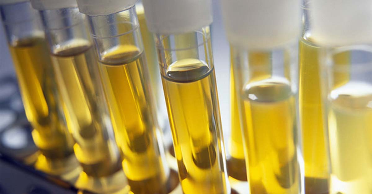 Study Food Allergy Diagnosed Via Urine SnackSafely