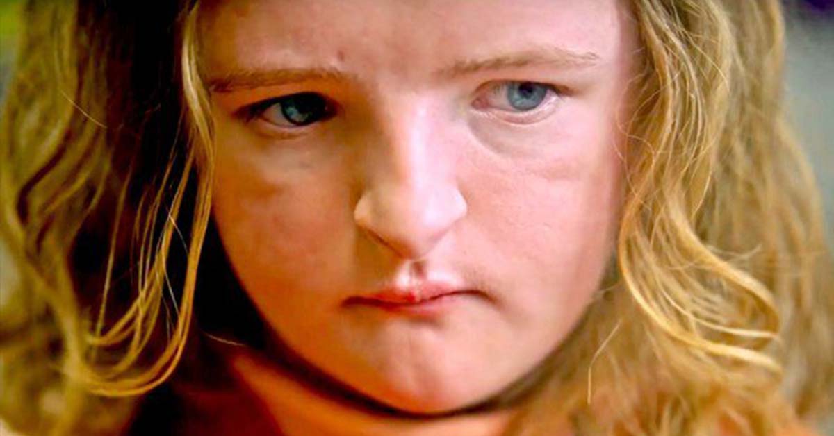 Advisory Disturbing Food Allergy Scene In ‘hereditary